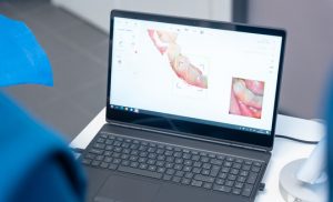 Компьютерная томография зубов в стоматологии
